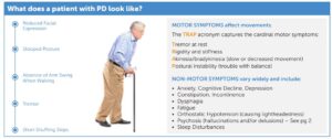 graphic depicting characteristics of Parkinson's disease